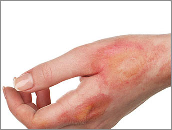 pierwsza pomoc przedmedyczna